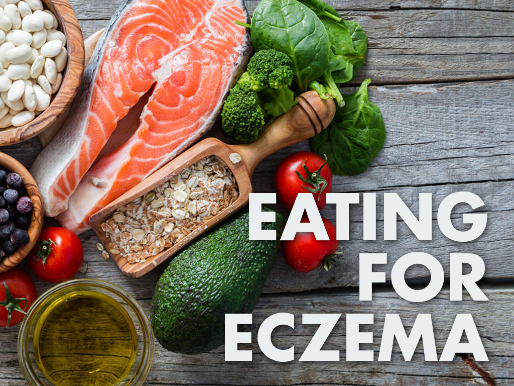 When eczema is eating you: Diet inspiration | Durban Skin Doctor