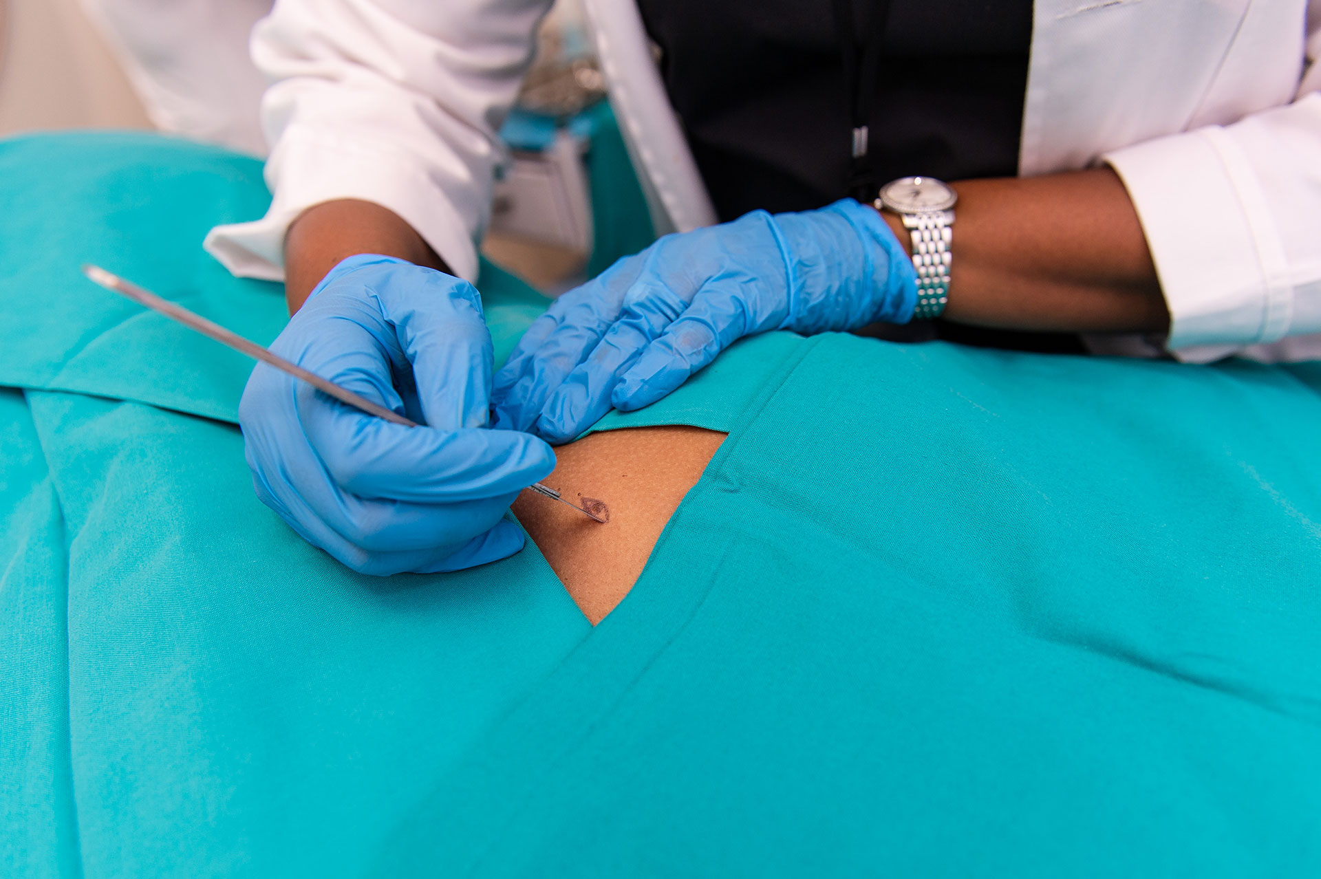 Surgical Dermatology | Dr Khoza Dermatologist