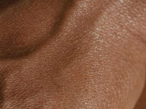 A detailed close-up of dry skin, showing dehydration and fine lines, highlighting the need for intense moisturisation.