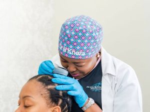 Dr Noks demonstrating hair loss treatment in south africa.